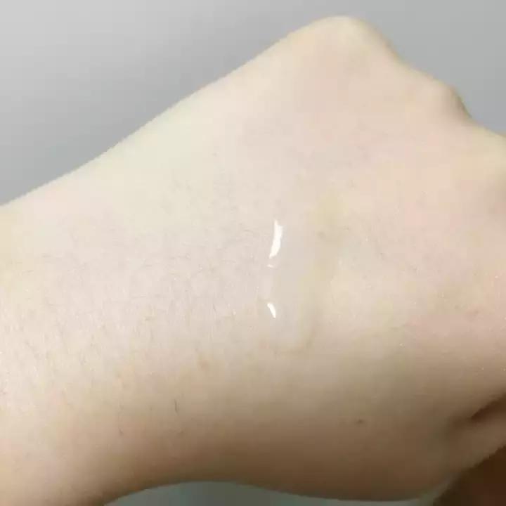 换季皮肤特别干怎么办,换季皮肤干痒用什么精华