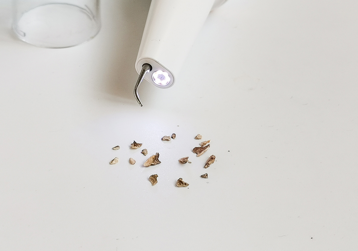 去除牙垢牙刷测评,洁牙神器和普通牙刷哪个好