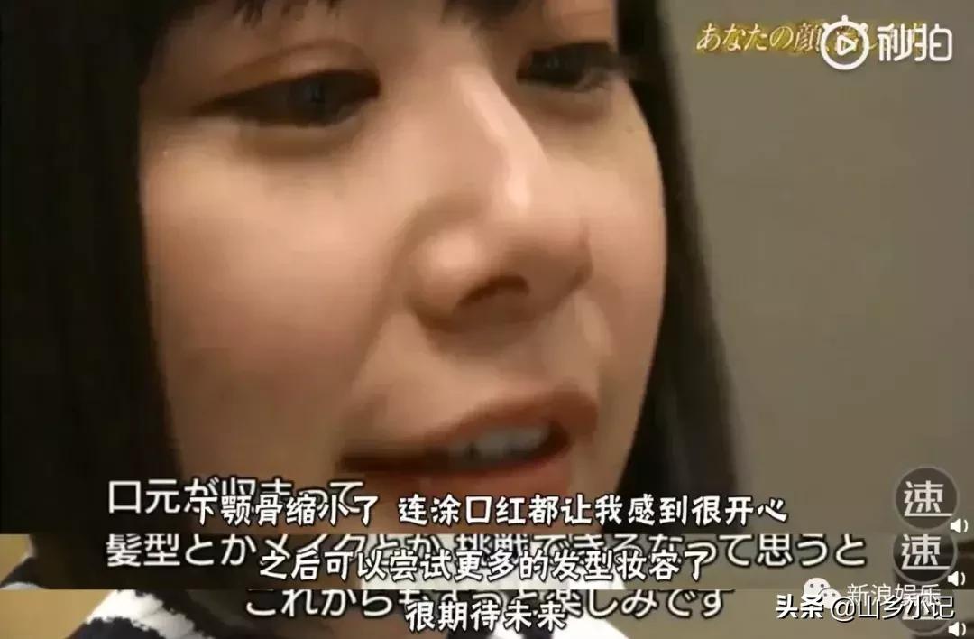 明明是整容脸现在却成了颜值巅峰,明明是整容脸却没被吐槽过