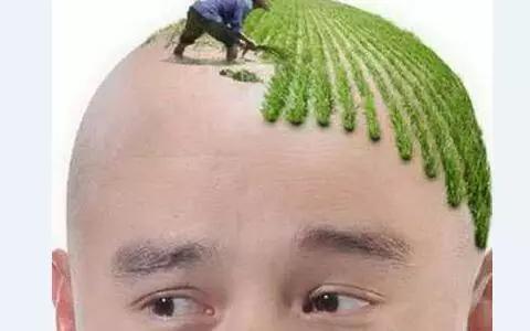 脱发能不能治好，要根据看你的脱发类型