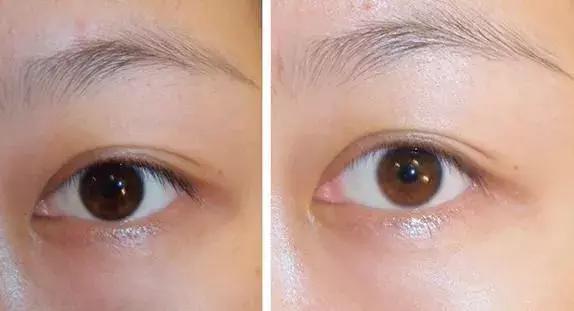 护肤反而皮肤差,改掉这些护肤恶习让你越变越美丽