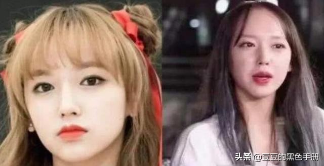 脑门大发际线高的女明星,大脸大脑门秃头女生适合的发型