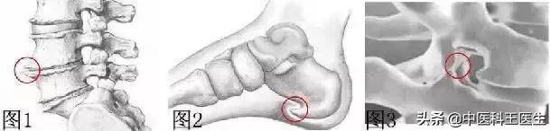 骨质增生中医内科能调理吗,骨质增生有什么药能治呢