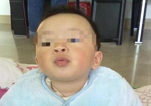 孩子撅嘴是牙齿的问题吗,孩子养成了总是噘嘴的习惯