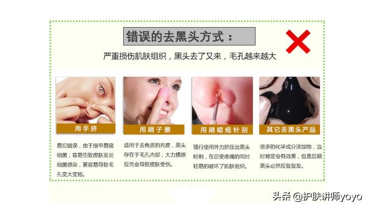 去黑头护肤正确过程,挤黑头之后怎么护肤