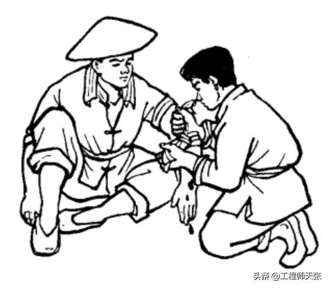 浙江男子走夜路被剧毒蛇咬，成功自救！做法实用，比教科书还经典