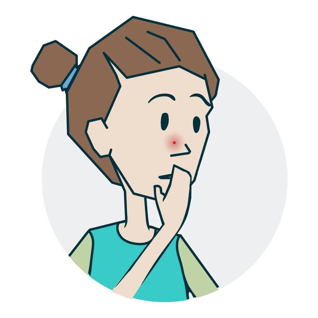 痘痘能不能挤会不会留坑,痘痘到底能不能挤