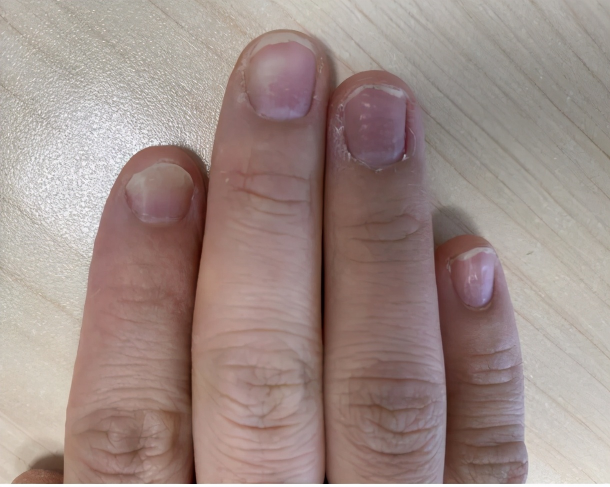 挑筋断骨切胃，那些为了美不要命的女人到底有多可怕