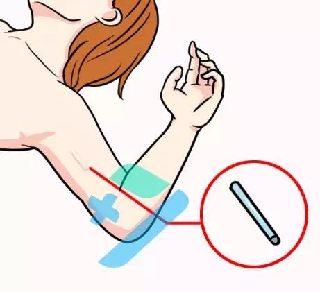 避孕棒的准确率有多高,避孕棒成功率