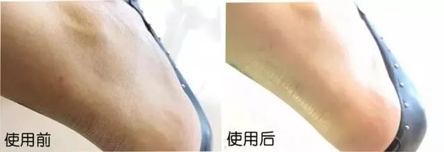 冬天手脚粗糙开裂小妙招,冬季手脚干裂怎么快速修复