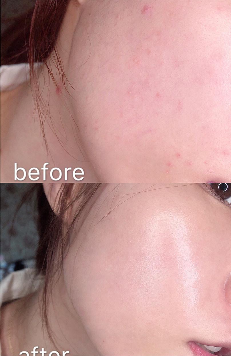 包文婧推荐的护肤品,包文婧用的哪些化妆品