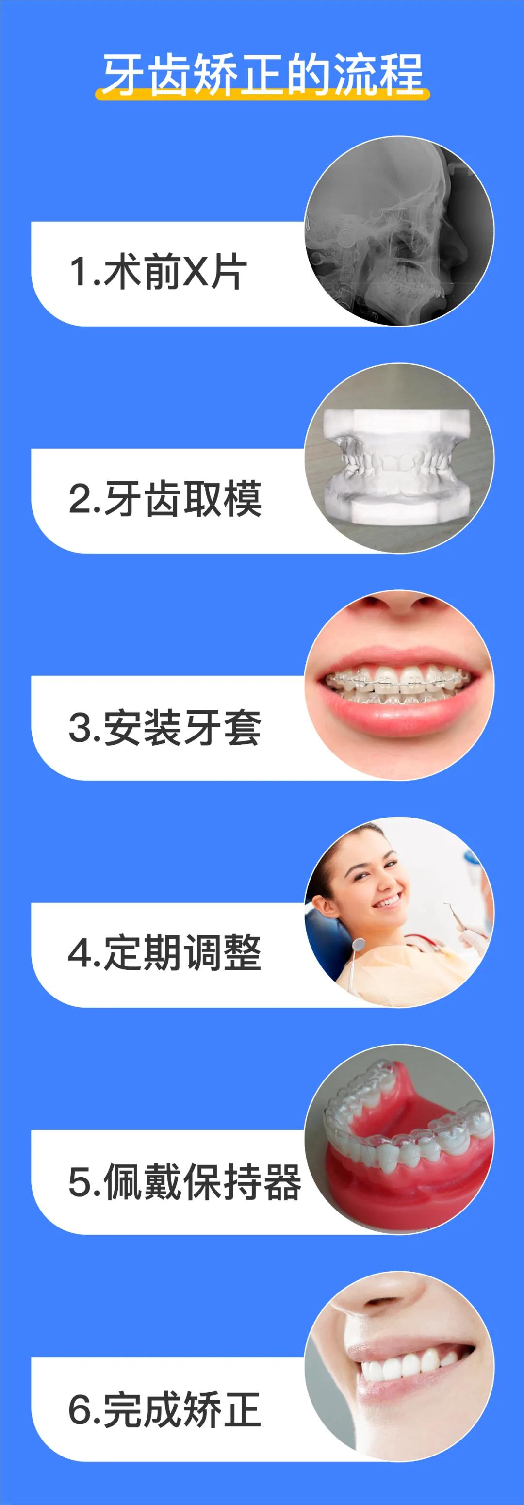 揭秘矫正牙齿多少钱,牙齿矫正全过程价格