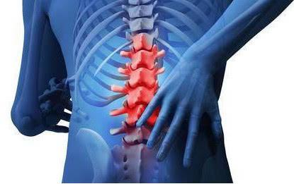 腰椎结核怎么治疗最有效,腰椎结核怎么治疗效果最好