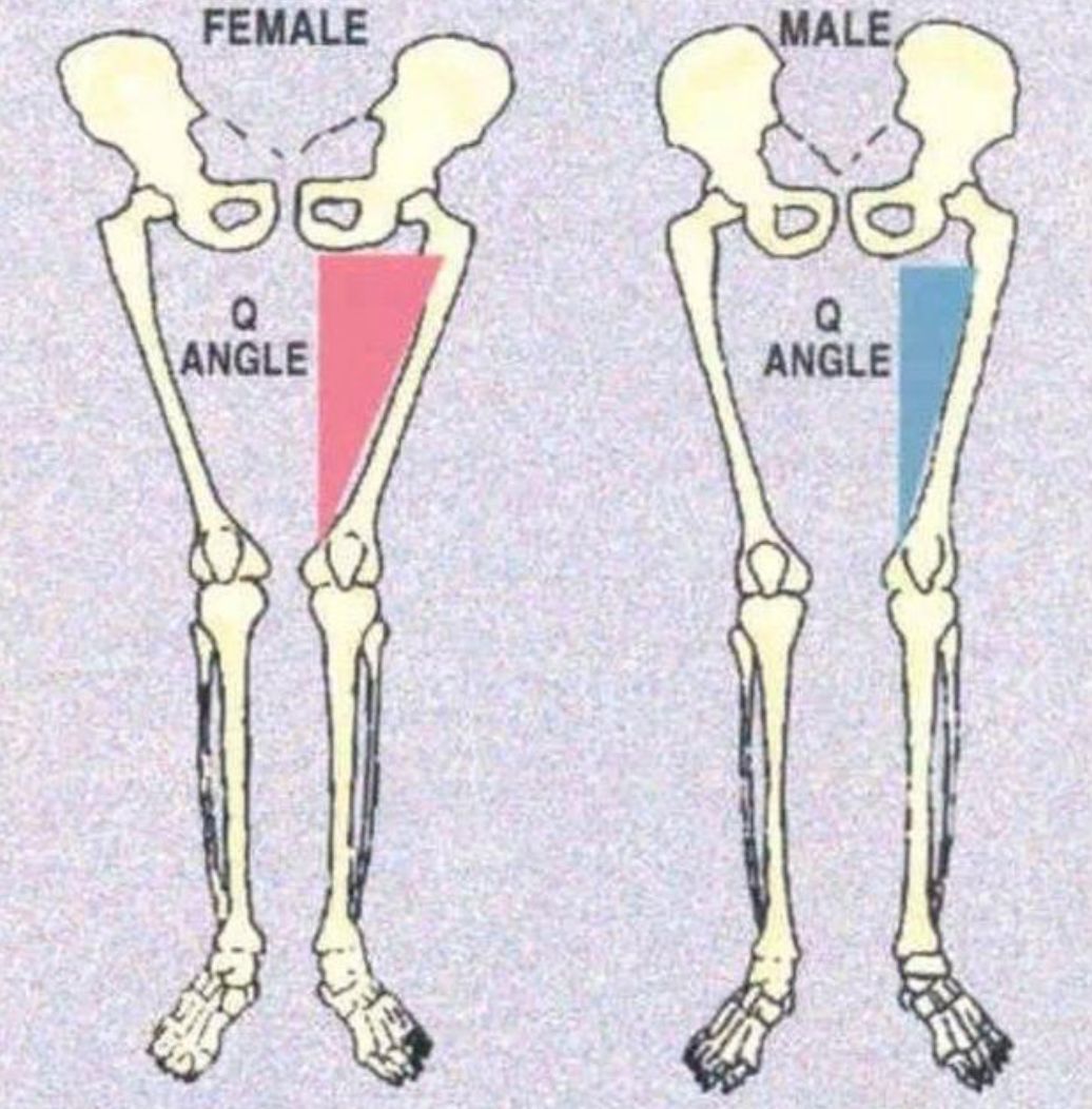 x型腿怎样矫正,青少年x型腿矫正最佳时间