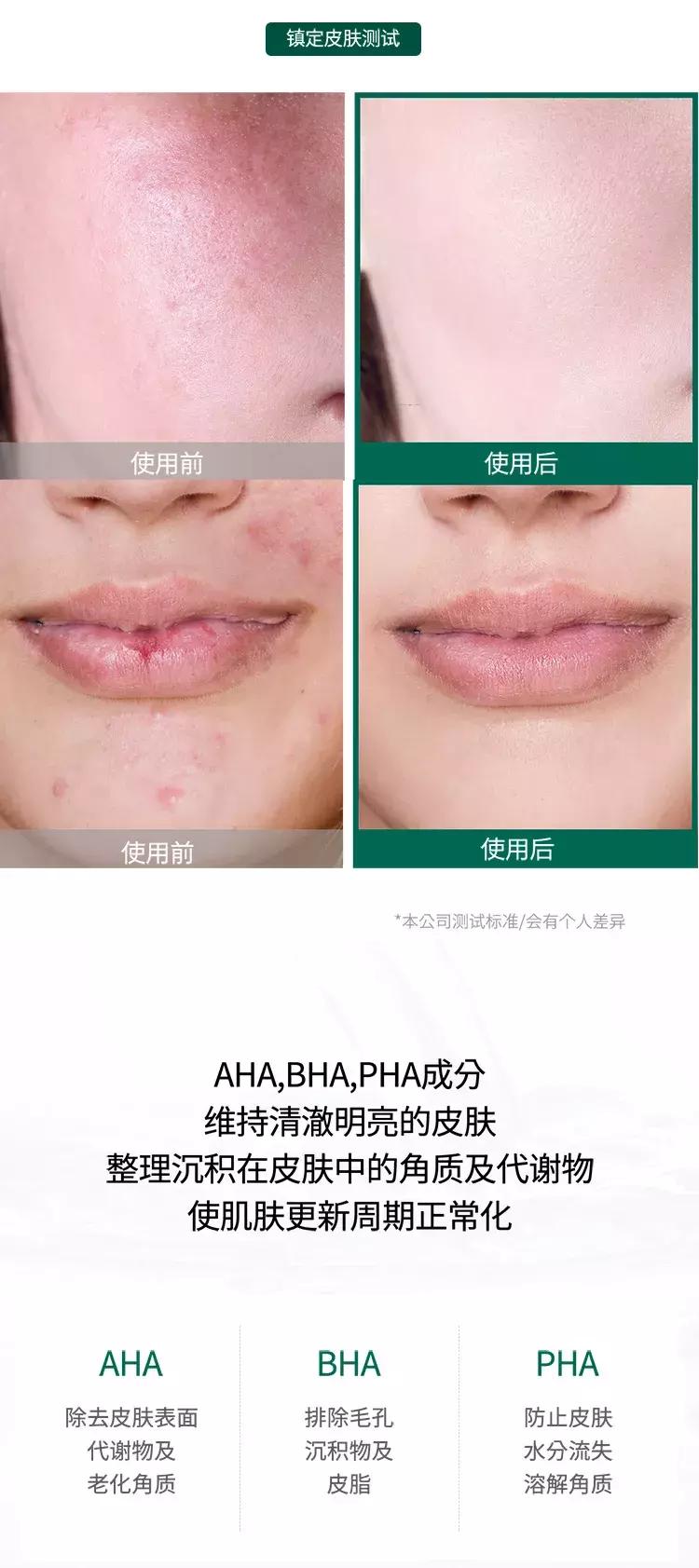 茶树somebymi爽肤水的使用方法,somebymi茶树精华