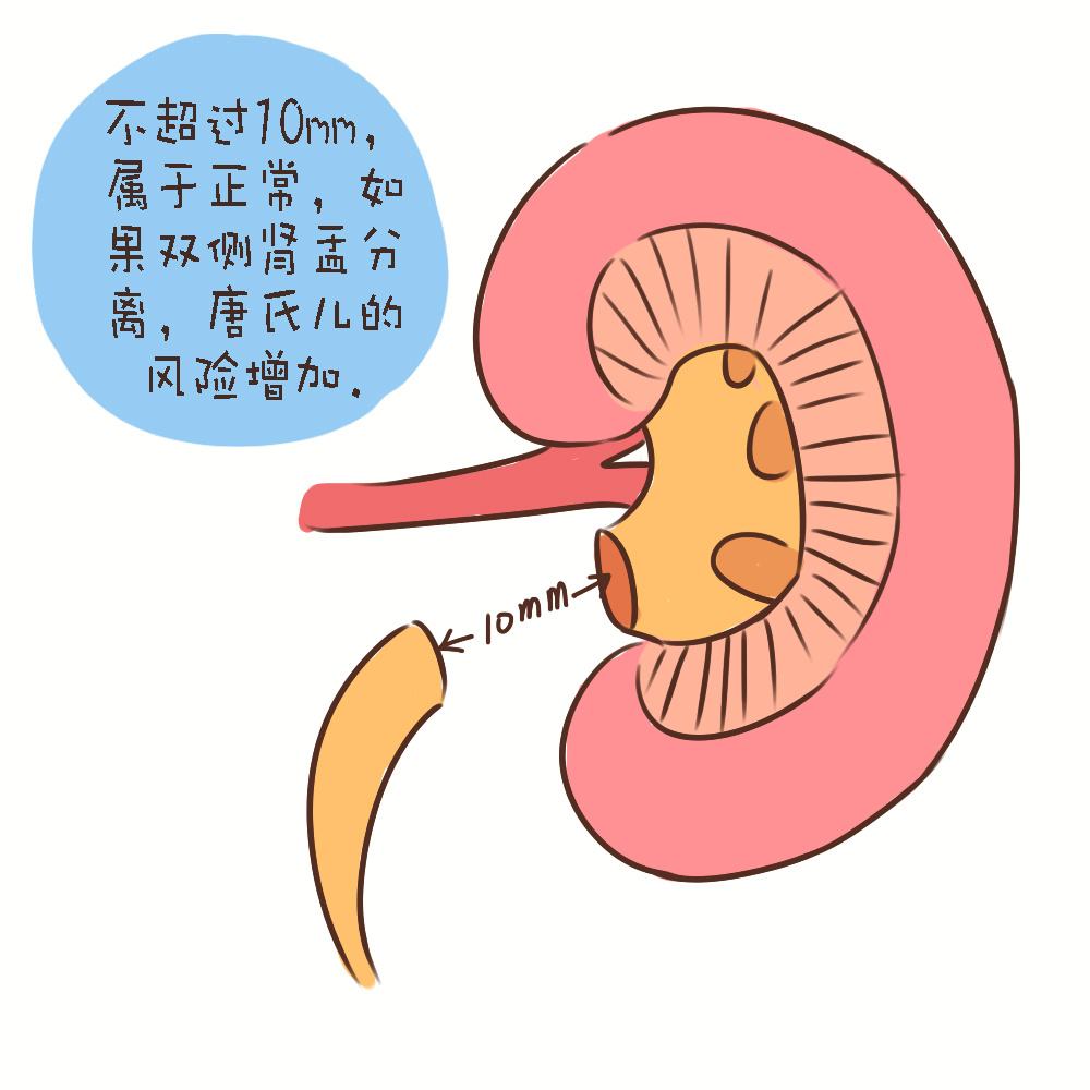 孕期四维超声结果参考,孕期四维检查结果怎么看