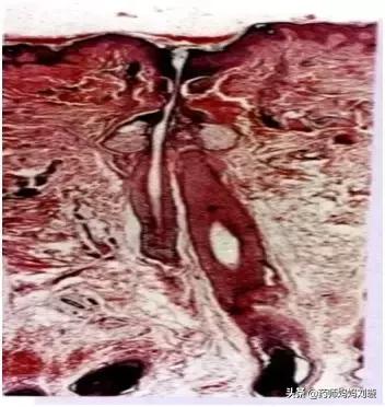 疮疡病的克星,清创宝典