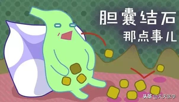 腹腔镜胆囊切除术后饮食护理问题,腹腔镜胆囊切除术后护理注意事项