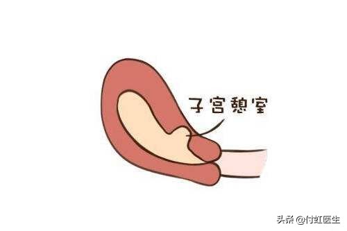 剖宫产后2年B超发现子宫里面出了“套间”,影响我要二宝吗?