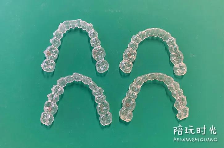 年糕妈妈没矫正牙齿之前样子,年糕妈妈整牙拔牙