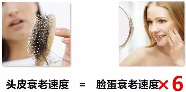 头油头屑痒洗发水,头油头皮屑多脱发洗发水