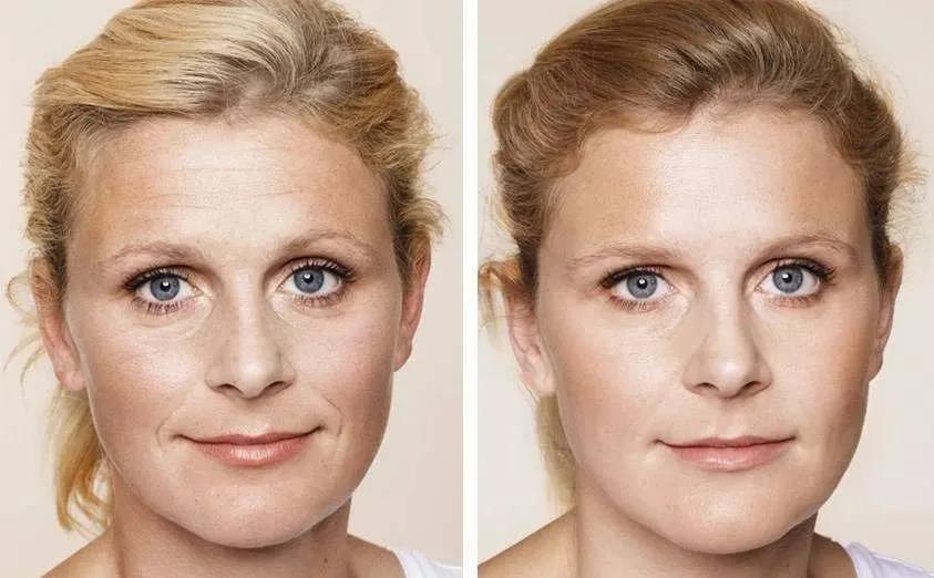 过度敷面膜皮肤屏障受损修复,警惕过度美容对皮肤的伤害