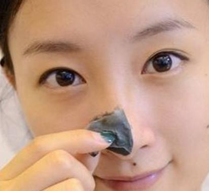 女孩子鼻子黑头怎么去除,鼻子上闭口黑头怎么去掉