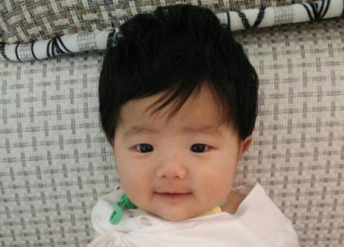 婴儿头发浓密和稀少的原因,宝宝出生头发浓密后面变稀少