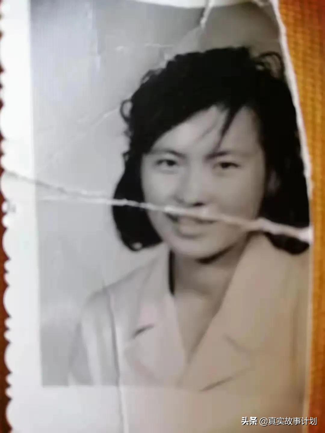 60岁皮肤松弛切眉整形,中老年脸部除皱纹整容手术