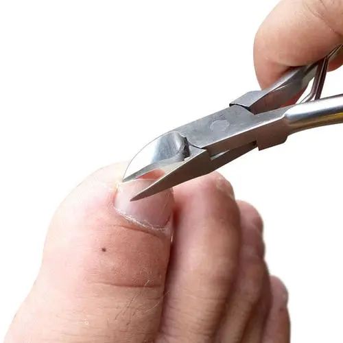 脚指甲两边向肉里扎,指甲小知识大全