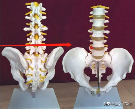 颈椎脊椎的精确定位及触诊技巧,脊椎三步定位图解