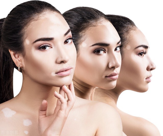 村里人说这个痣非“凶”即“淫”，吓得妈妈赶紧带孩子去点痣