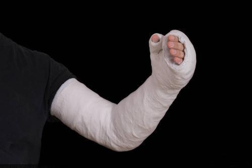 儿童轻微骨折恢复最佳的方法,骨科姚大夫的视频