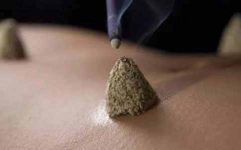 喵医生中医科普之冬病夏治の艾灸