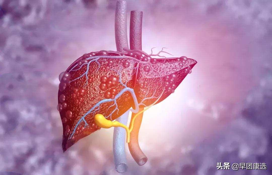 体检查出早期癌是不幸中的万幸么,年年体检为何一查出癌就是晚期