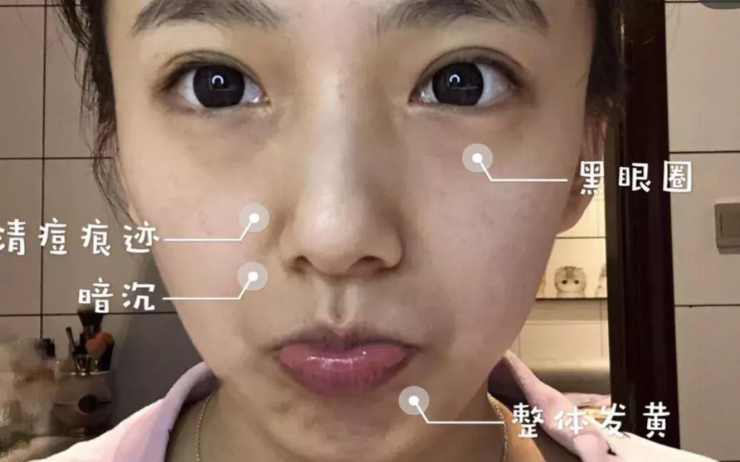 适合皮肤暗黄的护肤品李佳琦推荐,淡斑提亮肤色李佳琦推荐