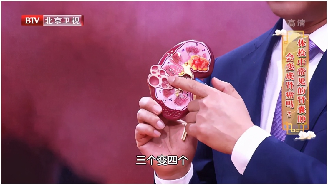 囊肿癌变最严重会怎么样,囊肿切除了又复发是癌变吗