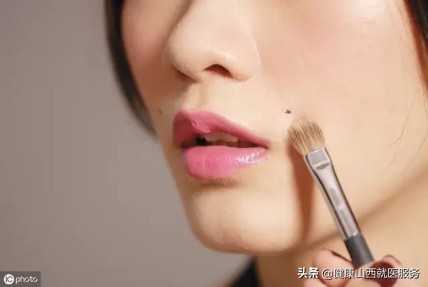 激光点掉的痣会恶变吗,激光点痣会诱发痣癌变是真的吗