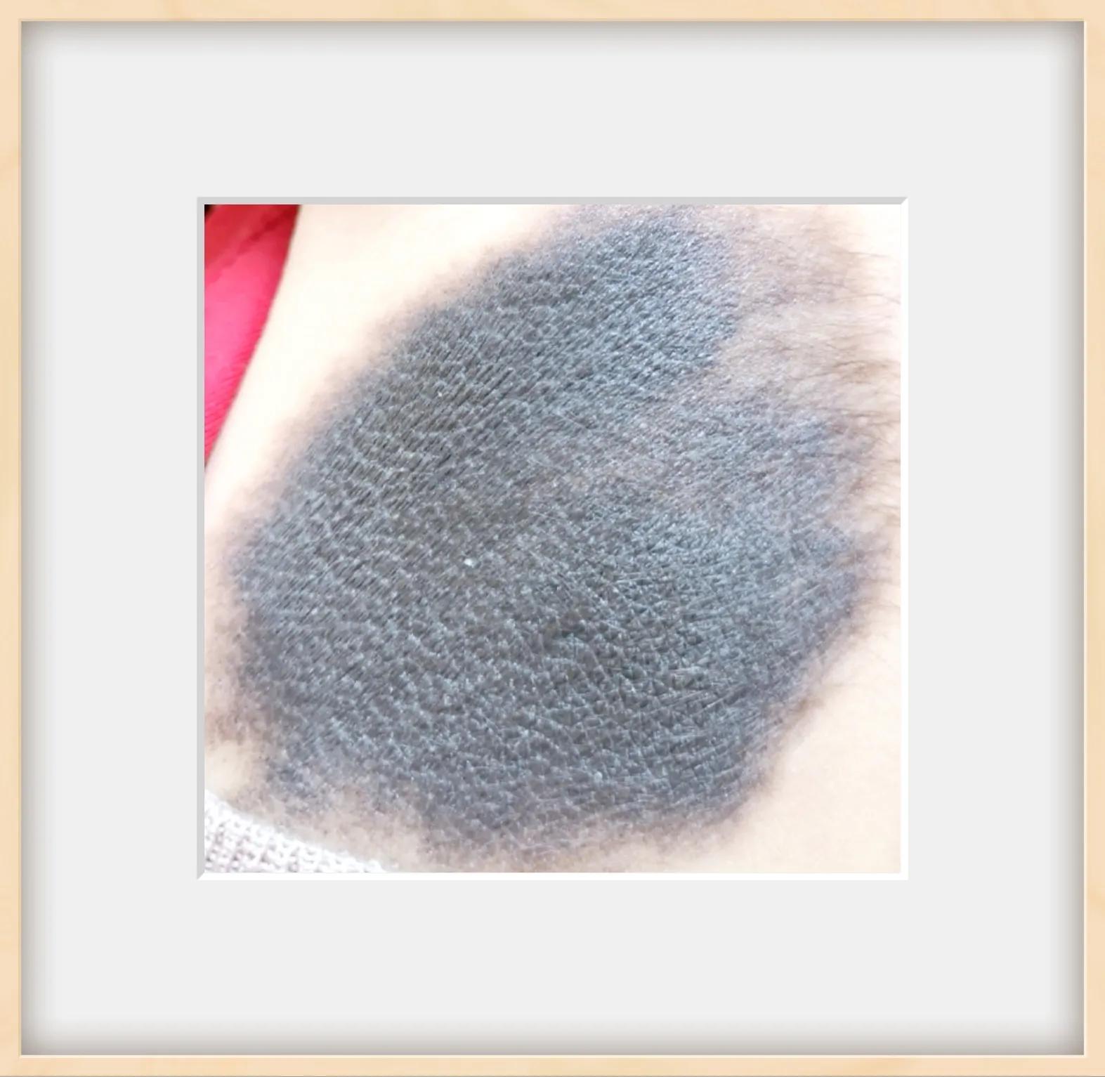 黑毛胎记科普,长满胎记的人