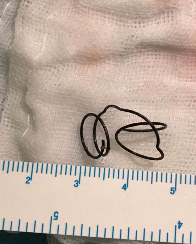 1岁的宝宝咳嗽呕吐,1岁宝宝呕吐咳嗽是怎么回事