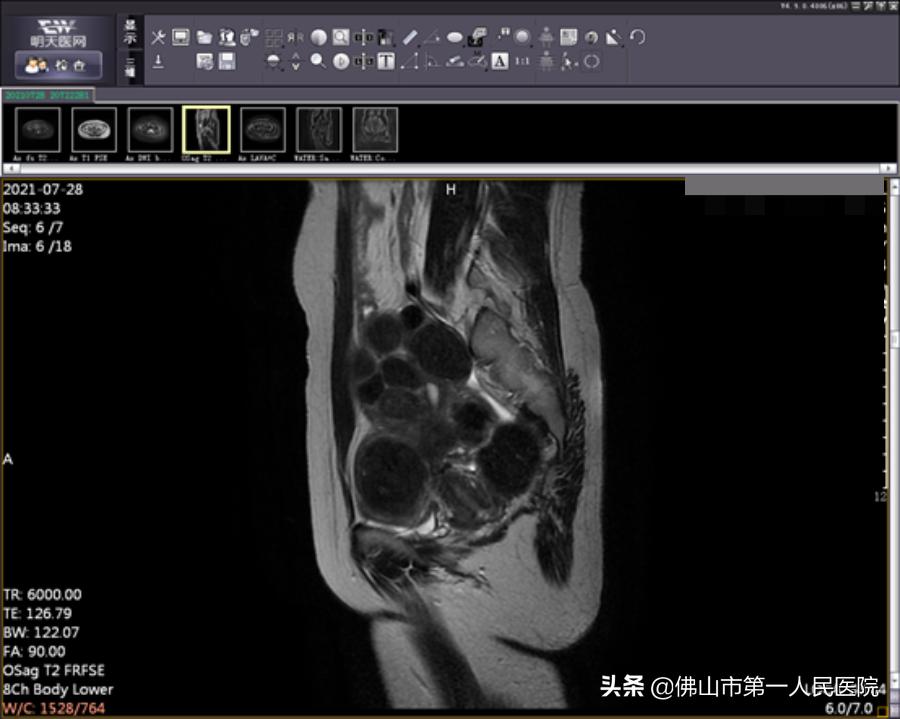 这把“刀”能隔山打“牛”,呵护子宫,带来好“孕”