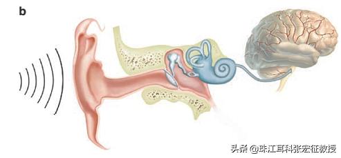 鼓膜穿孔不补会破得越来越大吗,鼓膜穿孔修复手术多少钱