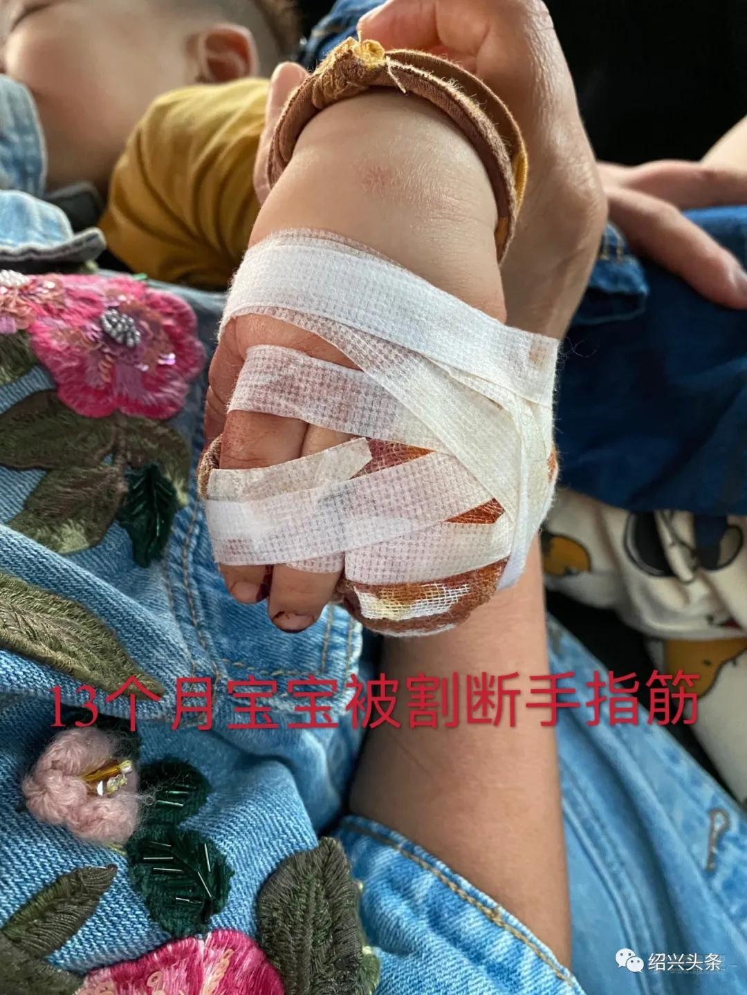 绍兴13个月宝宝在商场割断手指筋，现场血肉模糊，急送省儿保