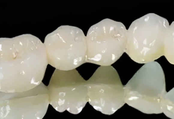 上海雅悦齿科种植牙,雅悦齿科种植牙