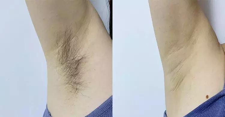 不做猕猴桃女孩是什么意思,不做猕猴桃女孩的图片