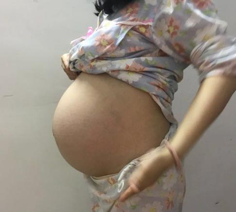 怀孕期间一直有炎症会影响胎儿吗,孕期一直有炎症对宝宝有影响吗