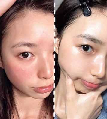 芦荟胶被神化,目前好用的芦荟胶