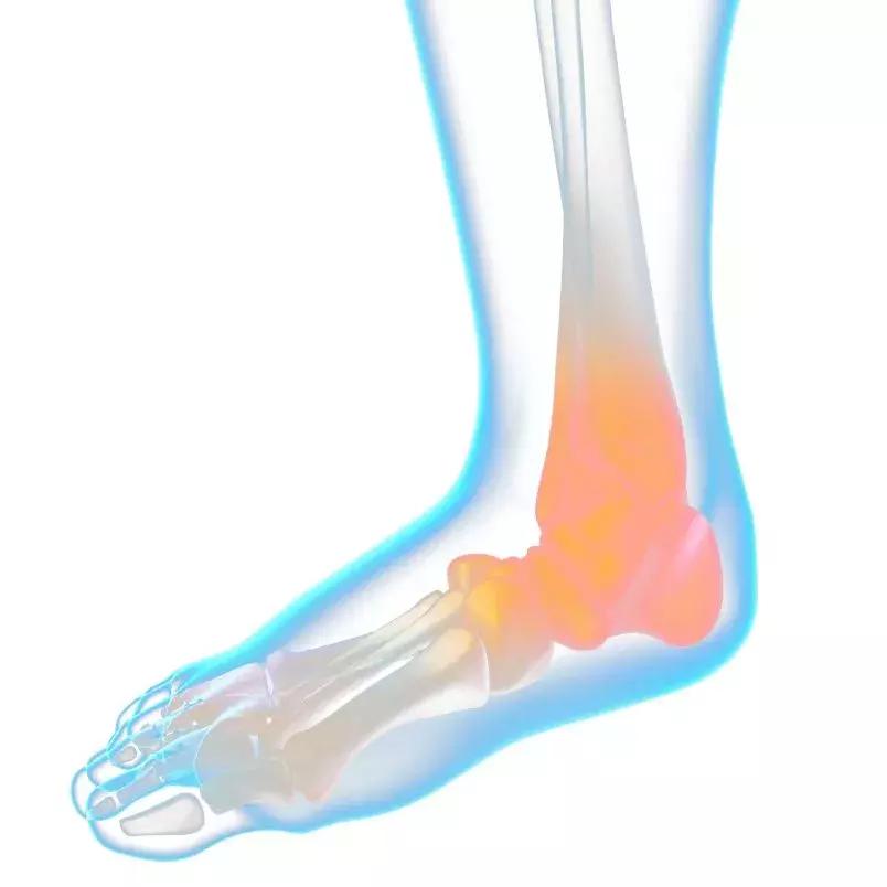 很多人崴了脚不知道该怎么办,那些崴脚后的人现在怎么样了