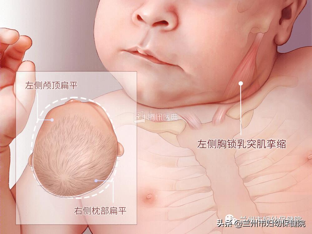 医疗救助小儿脑瘫公益,兰州市妇幼保健院产后修复