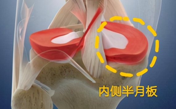 不同膝盖疼痛是暗示什么,不同位置的膝盖疼